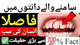 Danto K Darmyan Fasla, Gaip in teeth says your life facts & money - Urdu / Hindi