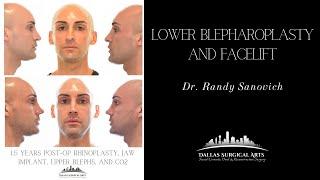 A Look Inside the OR: Jaw Implants and Rhinoplasty