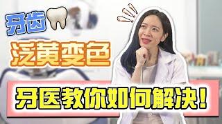 牙齿变白必知！