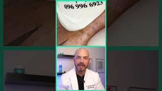 Derm reacts to massive blackheads! #dermreacts #doctorreacts #bla#blackheadextraction