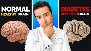 2 Crazy Ways High & Low Glucose Destroy Your Brain!