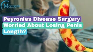 Peyronies Disease Surgery | Worried about losing Penis Length ?