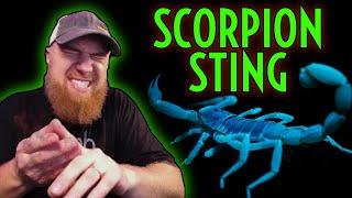 STUNG by the MOST VENOMOUS SCORPION in the USA! Arizona Bark - Centruroides sculpturatus