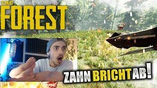 MiikaHD BRICHT ZAHN IM STREAM AB! - STREAM BEST OF 2020