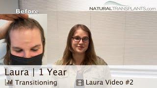 Transitioning Male to Female Hair Transplant for Feminizing Hairline | Dr. Kevin Blumenthal (Laura)