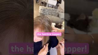 The Hairline Topper! 🫶 #hairline #hairtopper #thinhair #thinninghair #hairtoppersforwomen #tutorial