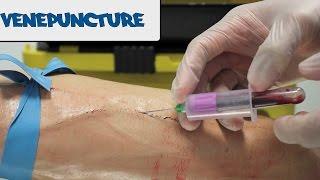 Venipuncture - How to take Blood - OSCE Guide (old version) | UKMLA | CPSA | PLAB 2