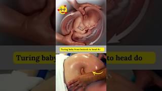 Turning Baby to Head Down Position  #shortvideo #ecv