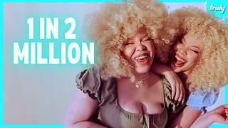 Identical Twins With Albinism Are 1 In 2 Million | BORN DIFFERENT