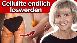 Cellulite: Nichts hilft dir so stark wie... (Prof packt aus)