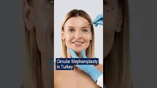 Blepharoplasty in Turkey The EASY Way to Perfect Eyes.#shorts #blepharoplastysurgery #plasticsurgery