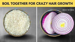 Boil Rice  + Onion  | HAIR GROWS LIKE CRAZY  Strengthens Hair and Prevents Hair Loss