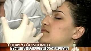 Non Surgical Nose Job LA | Rhinoplasty Beverly Hills