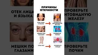 ПРИЧИНЫ ОТЁКОВ