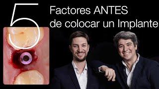  5 Factores IMPORTANTES ANTES de colocar un Implante Dental! - Formación en Implantología Básica