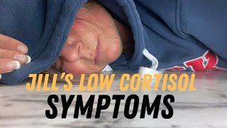 Addison's Disease - Jill's Low Cortisol Symptoms