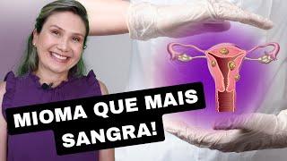 MIOMA que mais sangra é o submucoso.