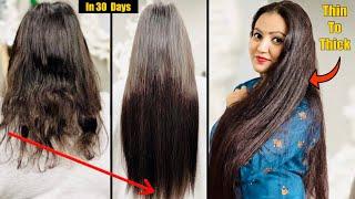 30 Days Challenge : Try This Miracle Hair Growth Treatment & Your Hair Will Never Stop Growing ️