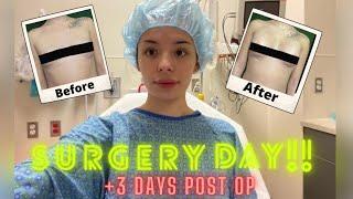 Boob Job / Top Surgery Day!! || +3 Days Post OP || Vlog #mtf #transgender