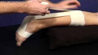 A Taping Technique for use in Achilles Tendon Injuries