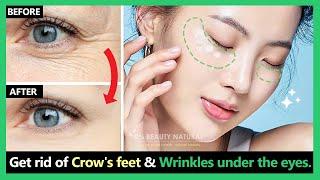 Stop Aging!! Get rid of deep crow's feet & wrinkles under the eyes by Korean massage & exercises.