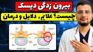 فتق دیسک چیست؟| دلایل٫علايم٫تشخیص و درمان بیرون زدگی دیسک