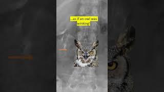 Winking Owl Sign! #mskrad