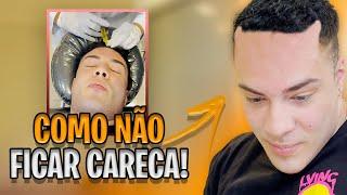 ESTÁ FICANDO CARECA?! PROCEDIMENTO PARA CRESCER O CABELO!