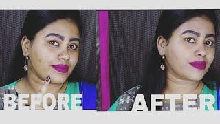 How to Conceal Blemishes/ Pimples / Dark Spots || Indian || Prachi Kalgutkar