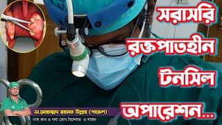 টনসিল অপারেশনের(Tonsillectomy) ভিডিও সরাসরি 