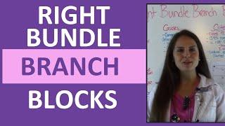 How to Interpret EKG Right Bundle Branch Blocks on ECG for Nurses