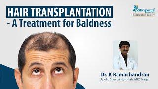 Hair Transplant – Effects & Treatments.