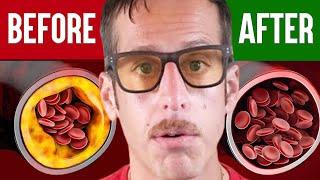 The Best Meal To Clear Out Your Arteries | Ben Azadi