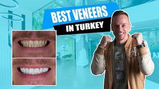 #SmileTransformation: Dental Treatment Experiences at Myra Dental Centre in Antalya