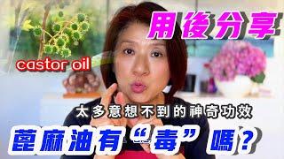 （573）【家庭必備萬用油】澳洲藥店特別火的蓖麻油太多意想不到的神奇功效！從遠古時代就被用於治療各種疾病，包括頭髮和皮膚護理。用蓖麻油治療頭髮斷裂和促進頭髮生長早已被公認為替代健康領域！