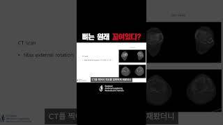 키수술, 모든 방향에서 보고 수술 해야 하는 이유
