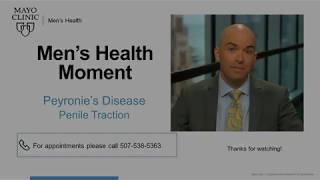 Men's Health Moment: Peyronie's Disease Penile Traction