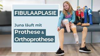 Was ist eine Orthoprothese? | Hilfsmittel zum Gehen bei angeborener Fehlbildung