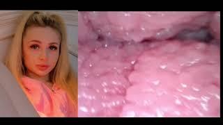 periscope Live broadcast Vlog LOVELYGIRL 2024 | bigo live 0015