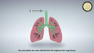 Nanoparticle-modified Microrobots for Vivo Antibiotic Delivery to Treat Acute Bacterial Pneumonia