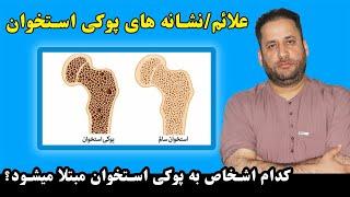 علائم پوکی استخوان چیست؟ | کدام اشخاص بیشتر به پوکی استخوان مبتلا میشود | Symptoms of Osteoporosis