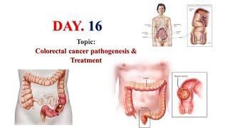 oncology course day 16 | #Colorectal_Cancer | #treatment | #folfox regimen |#PharmD