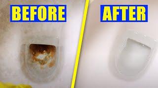 How To Remove Hard Water Stains From Toilet Bowl