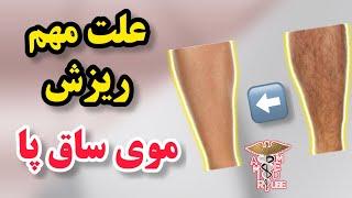 علت ریزش موهای ساق پا و براق شدن پوست پا چیست؟