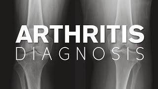 How do I determine if I have arthritis?