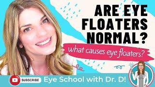 Do You Have Eye Floaters? | Are Eye Floaters Normal? | An Eye Doctor Explains