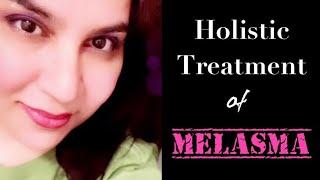 MELASMA TREATMENT in SKIN OF COLOR  (long-term, holistic, evidence based, safe) - Dr.Ansul Khan