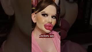 World's largest lips girl will make world`s sharpness chin