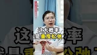 #男性 #女性 #硬核健康科普行动 #女性健康