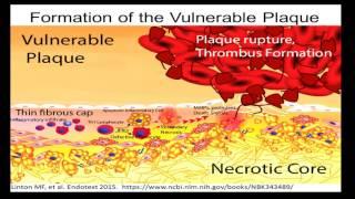 Macrophage Apoptosis and Efferocytosis in Atherosclerosis: A Matter of Life and Death